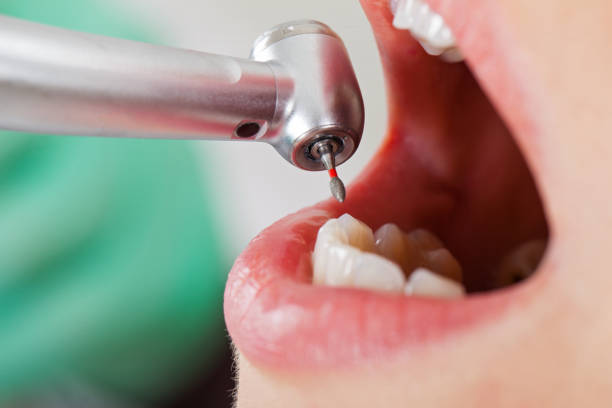 Best Cosmetic Emergency Dentistry in Manistique, MI